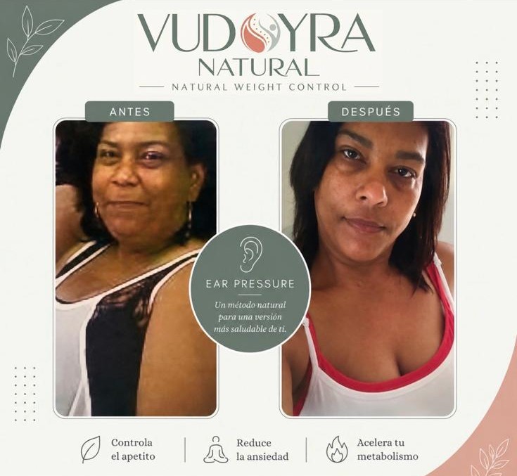 Antes y después — paciente 22