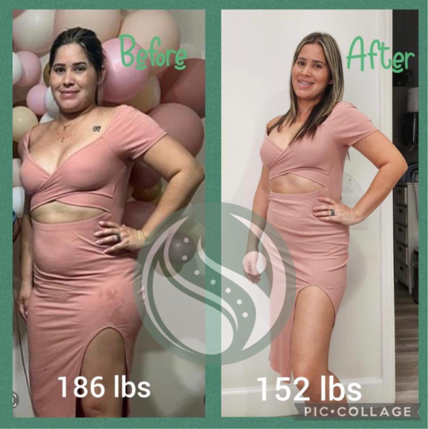 Antes y después — paciente 1
