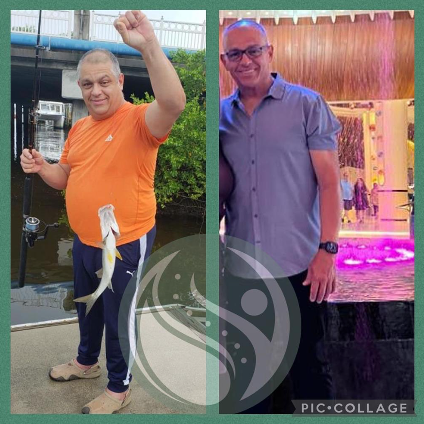 Antes y después — paciente 4